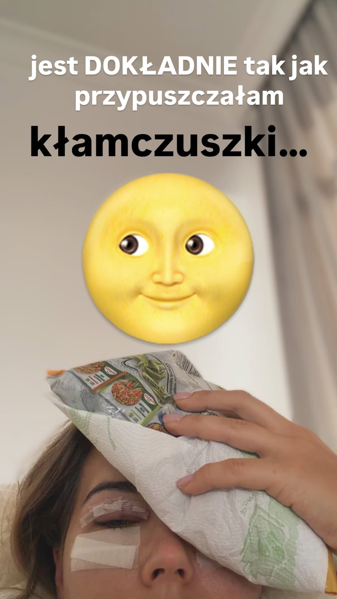 Sandra Kubicka pokazała całą operację. Wycieli jej masę skóry