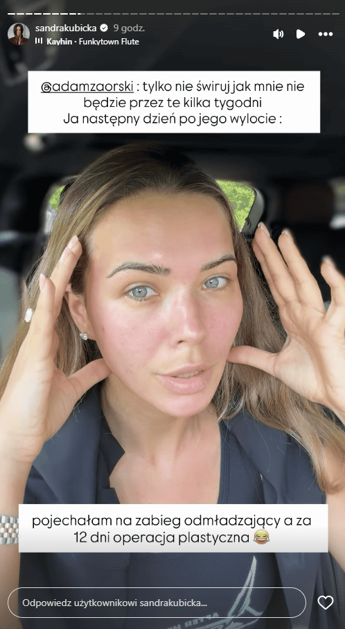 Sandra Kubicka: "Już nie będę tak wyglądać". Taką operację zaplanowała