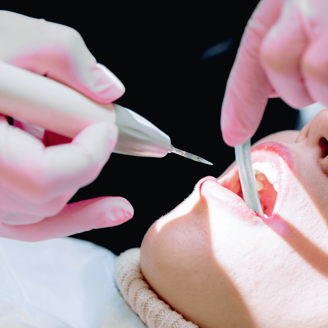 Nowe zasady u dentysty od 1 września. Zrobisz to za darmo