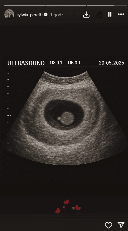 Sylwia Peretti pokazała zdjęcie USG. Szczęśliwa czeka na nowego członka rodziny
