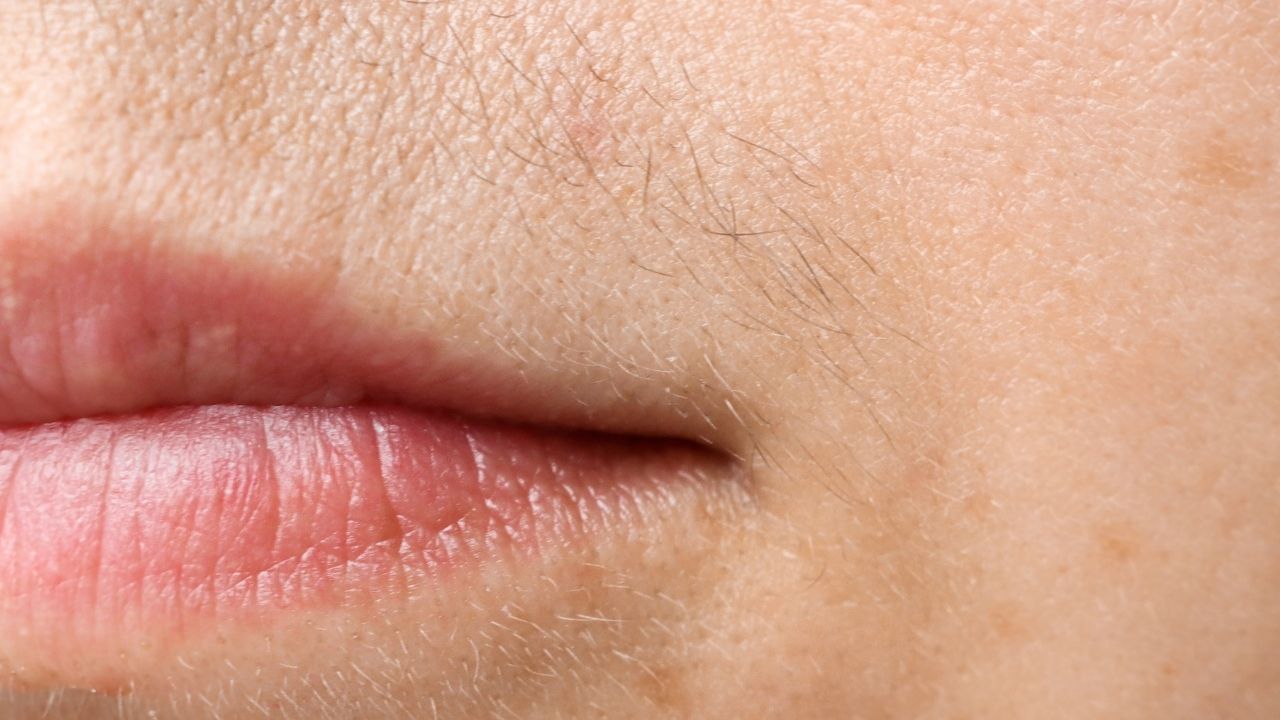 Kobiecy wąsik znika w mgnieniu oka. To działa jak laser, a kosztuje grosze