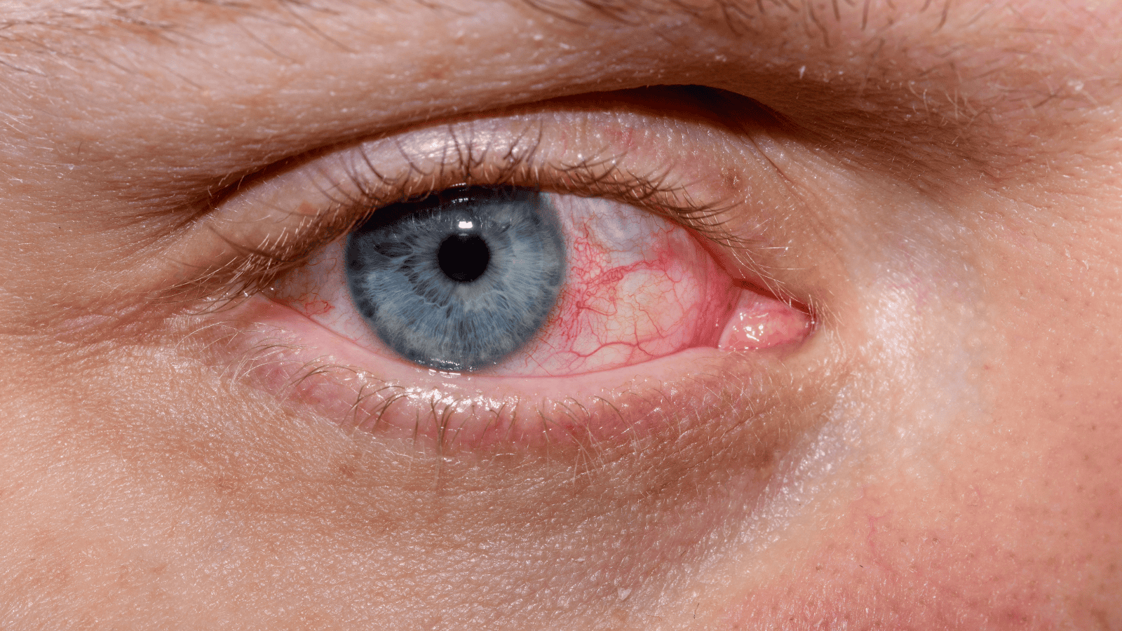 7 objawów nieswoistych chorób zapalnych jelit. Lekarz apeluje: "Nigdy ich nie ignoruj"