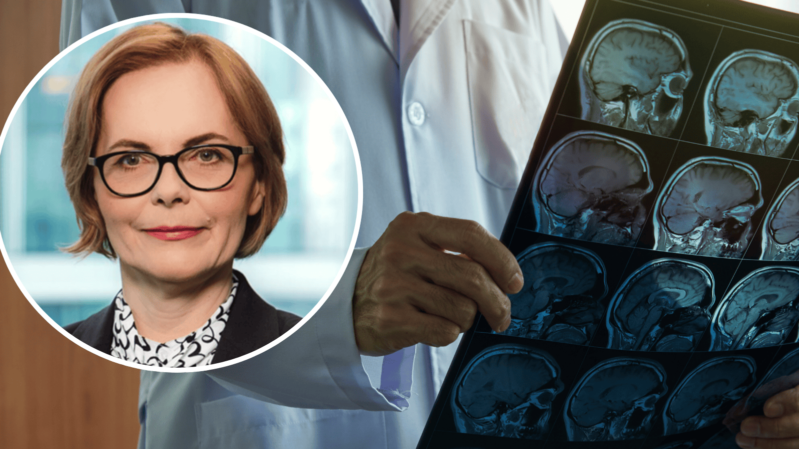 90 tysięcy udarów rocznie. Czy polska neurologia wygra walkę o zdrowie pacjentów?