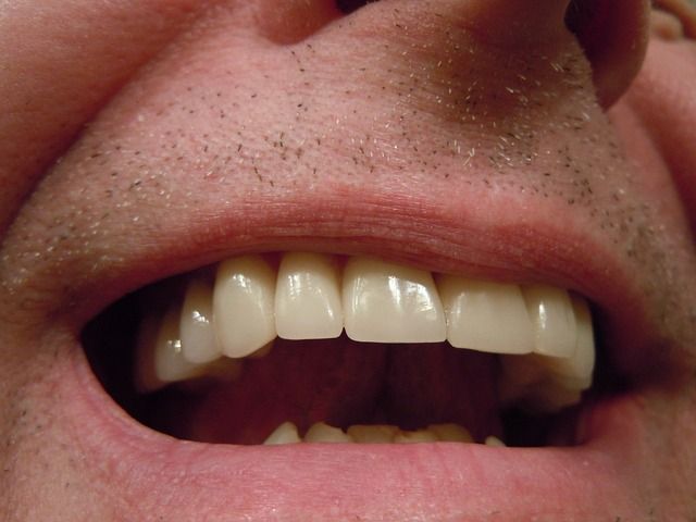 Ból zęba – przyczyny, leczenie, domowe sposoby na bóle zębów