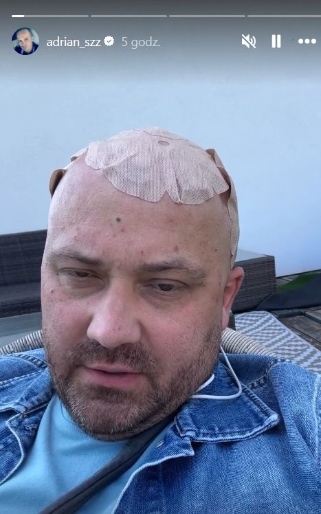 Adrian ze "ŚOPW" mówi o obrzęku mózgu. Takie ma objawy