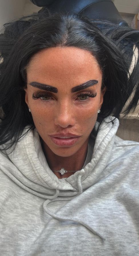 Co ona sobie zrobiła z twarzą? Była ikoną, a teraz trudno ją rozpoznać