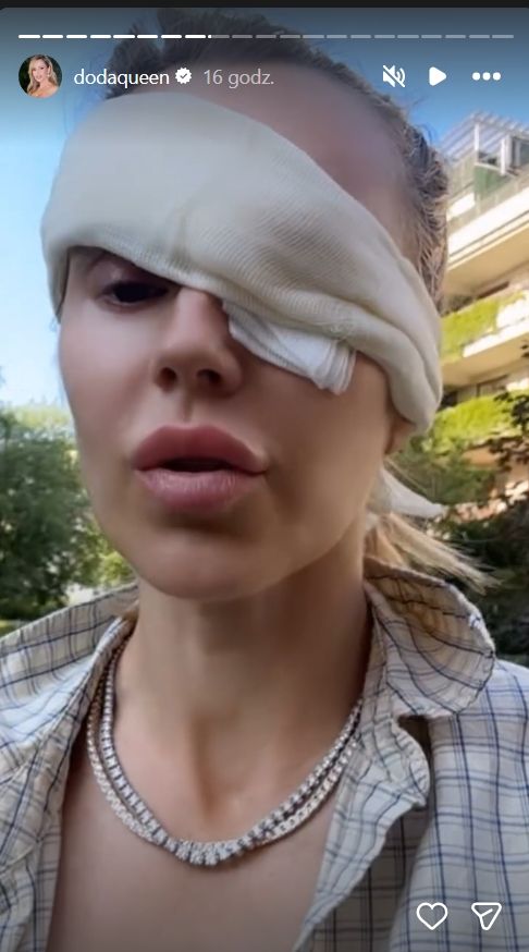 Doda z tajemniczym opatrunkiem na twarzy. Aż trudno uwierzyć, co ją spotkało