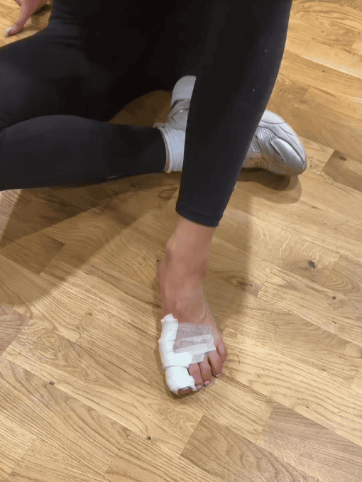 Dramat Hani Żudziewicz tuż przed nowym odcinkiem „TzG”. Tak teraz wygląda jej stopa, boli od samego patrzenia