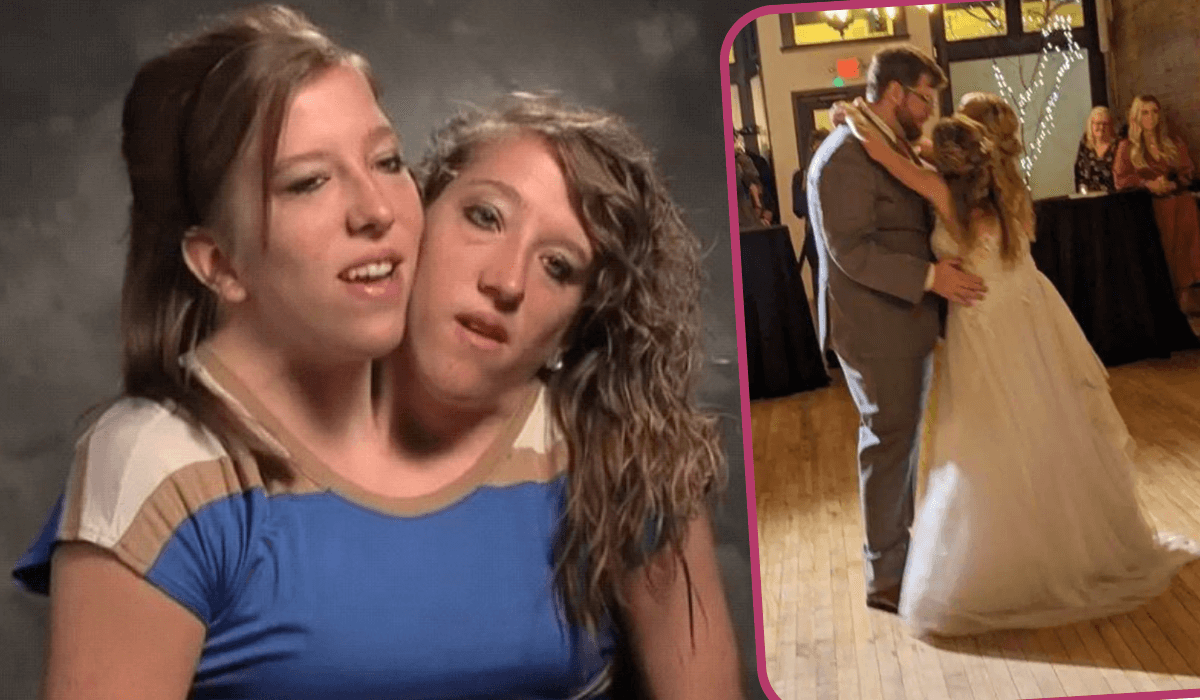 bliźniaczki syjamskie Abby i Brittany Hensel, ślub, relacje między nimi, co się wydarzyło