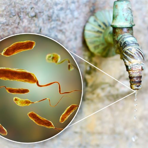 cholera Fot. Canva.jpg