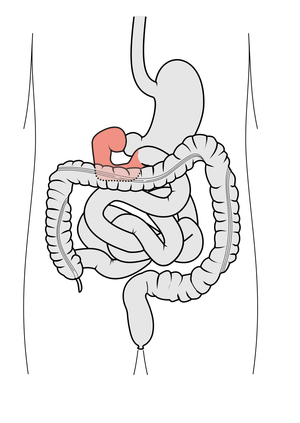 Tomasz Jakubiak zmarł na raka dwunastnicy. Takie są pierwsze objawy choroby