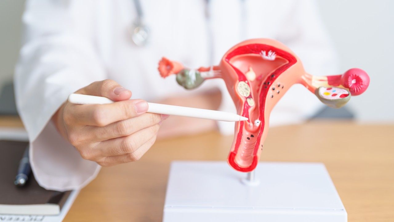 endometrioza