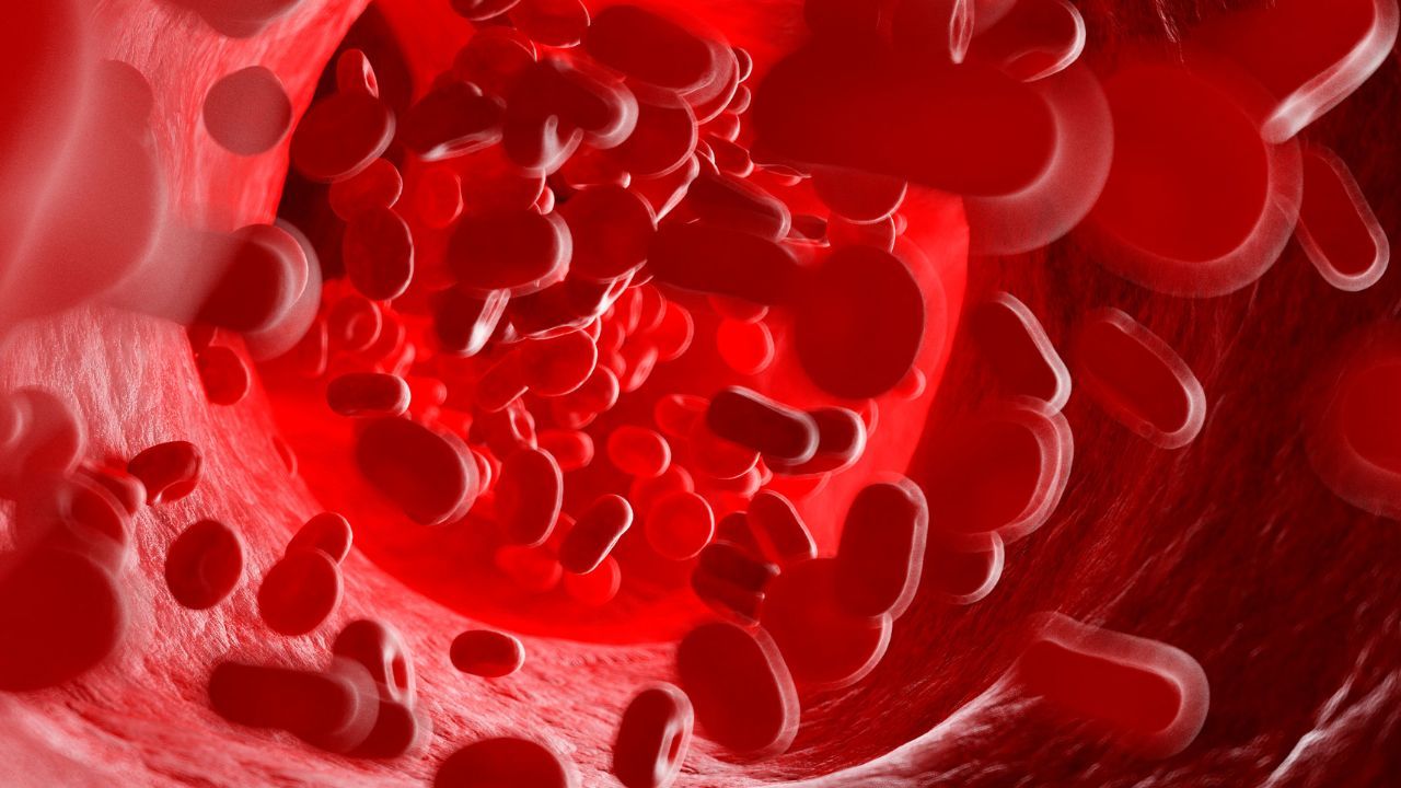 Zakrzepica nie daje wyraźnych objawów. Umiera na nią co czwarty chory