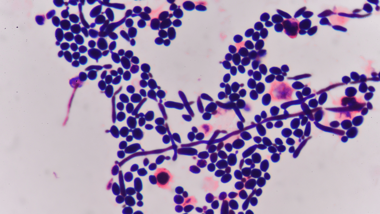 Tych testerów lepiej nie testuj! Nie uwierzysz, co mikrobiolog znalazła w cieniach do powiek