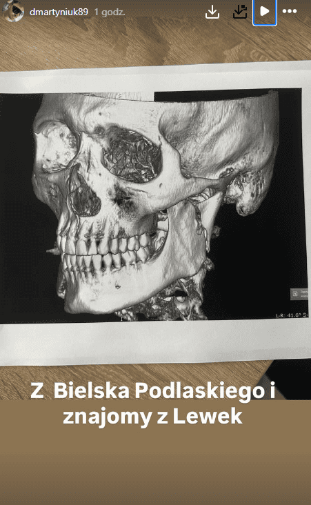 Poruszony Daniel Martyniuk to ogłosił. "Pobity przez własną rodzinę"