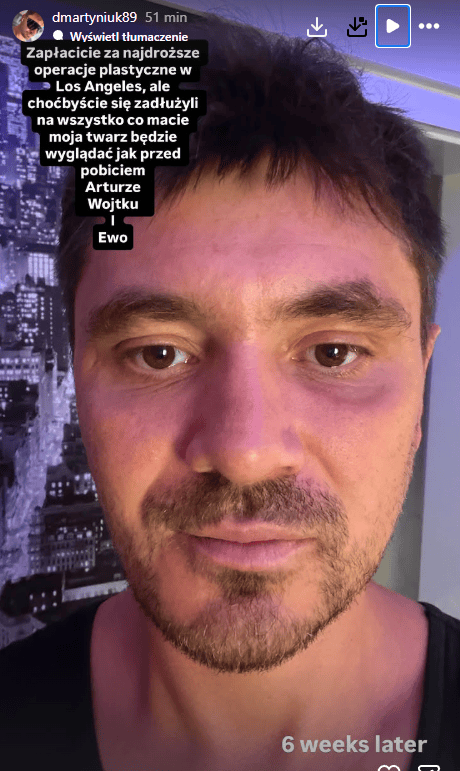 Najpierw oskarżył rodzinę o pobicie, a teraz to. Daniel Martyniuk wyjechał z Polski