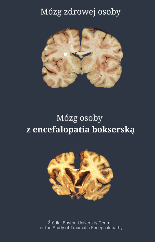 Zbigniew Raubo bez cenzury: Najszybciej pokona się wroga, którego kochamy [WYWIAD]