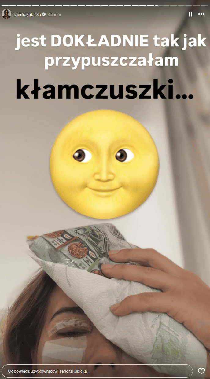 Sandra Kubicka pokazała twarz po operacji. To nie wygląda dobrze