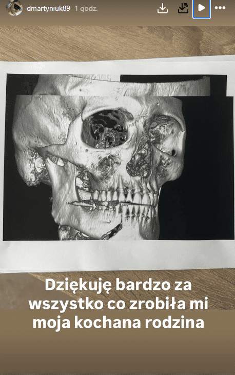 Poruszony Daniel Martyniuk to ogłosił. "Pobity przez własną rodzinę"