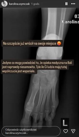 Żona Piotra Adamczyka trafiła do szpitala. Zdała relację prosto z Bali