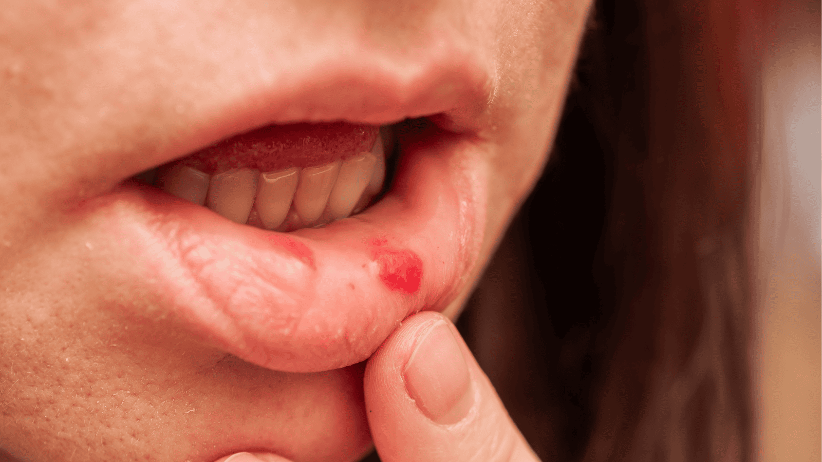 7 objawów nieswoistych chorób zapalnych jelit. Lekarz apeluje: "Nigdy ich nie ignoruj"