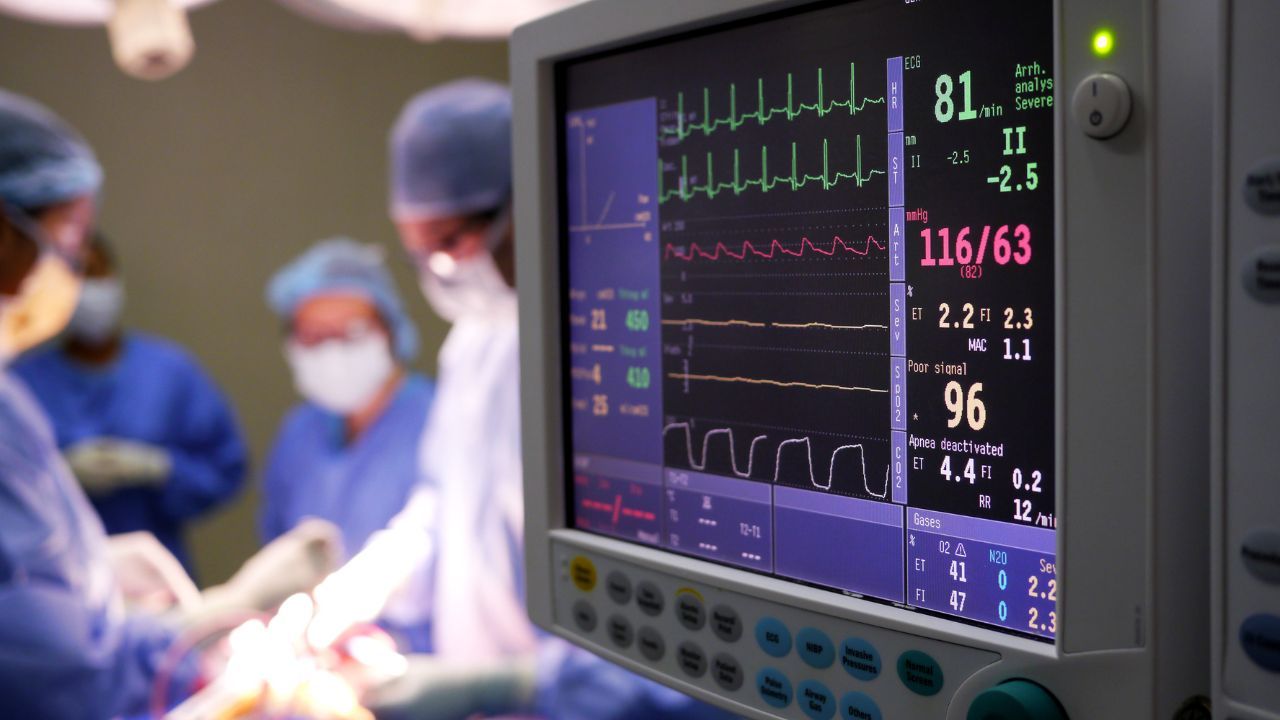 operacja monitor.jpg