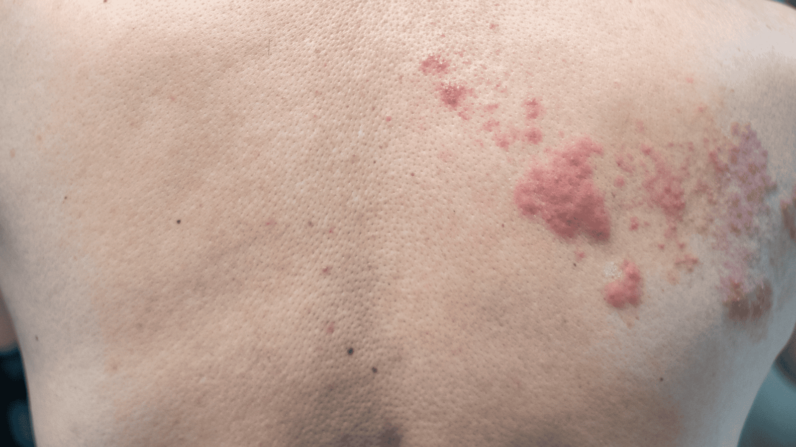 Redakcja Pacjenci.pl