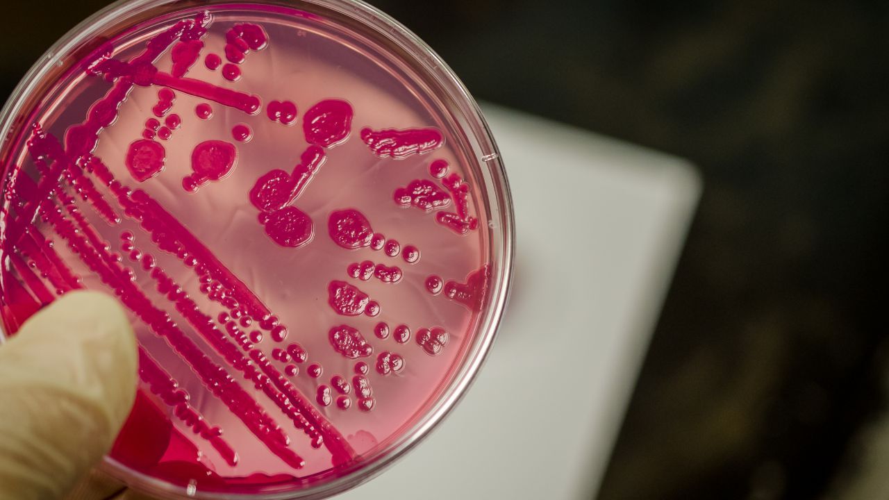 salmonella.jpg