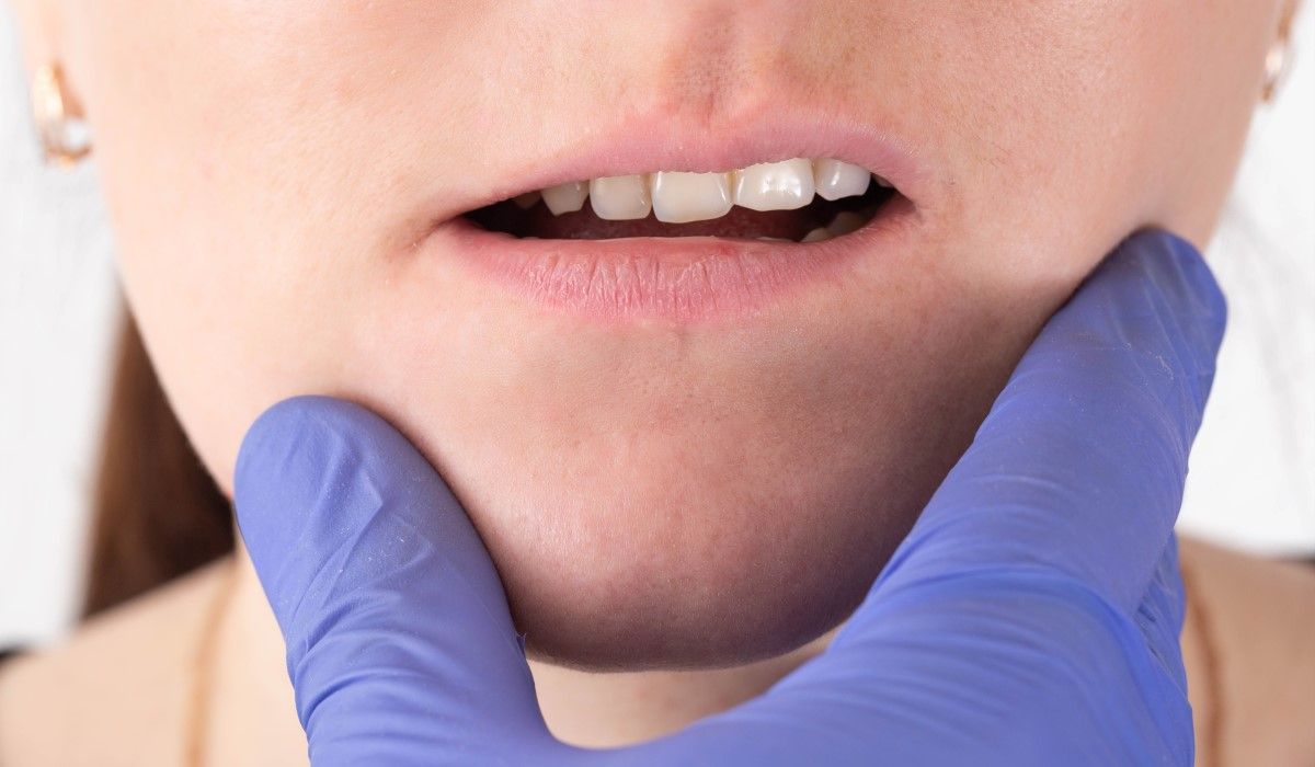 Pacjent z wadą zgryzu u ortodonty
