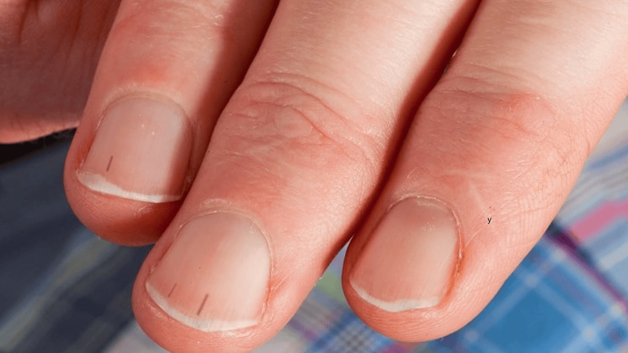 Tak serce daje znać, że zaraz wysiądzie. Zapalenie mięśnia sercowego zdradza objaw na stopach