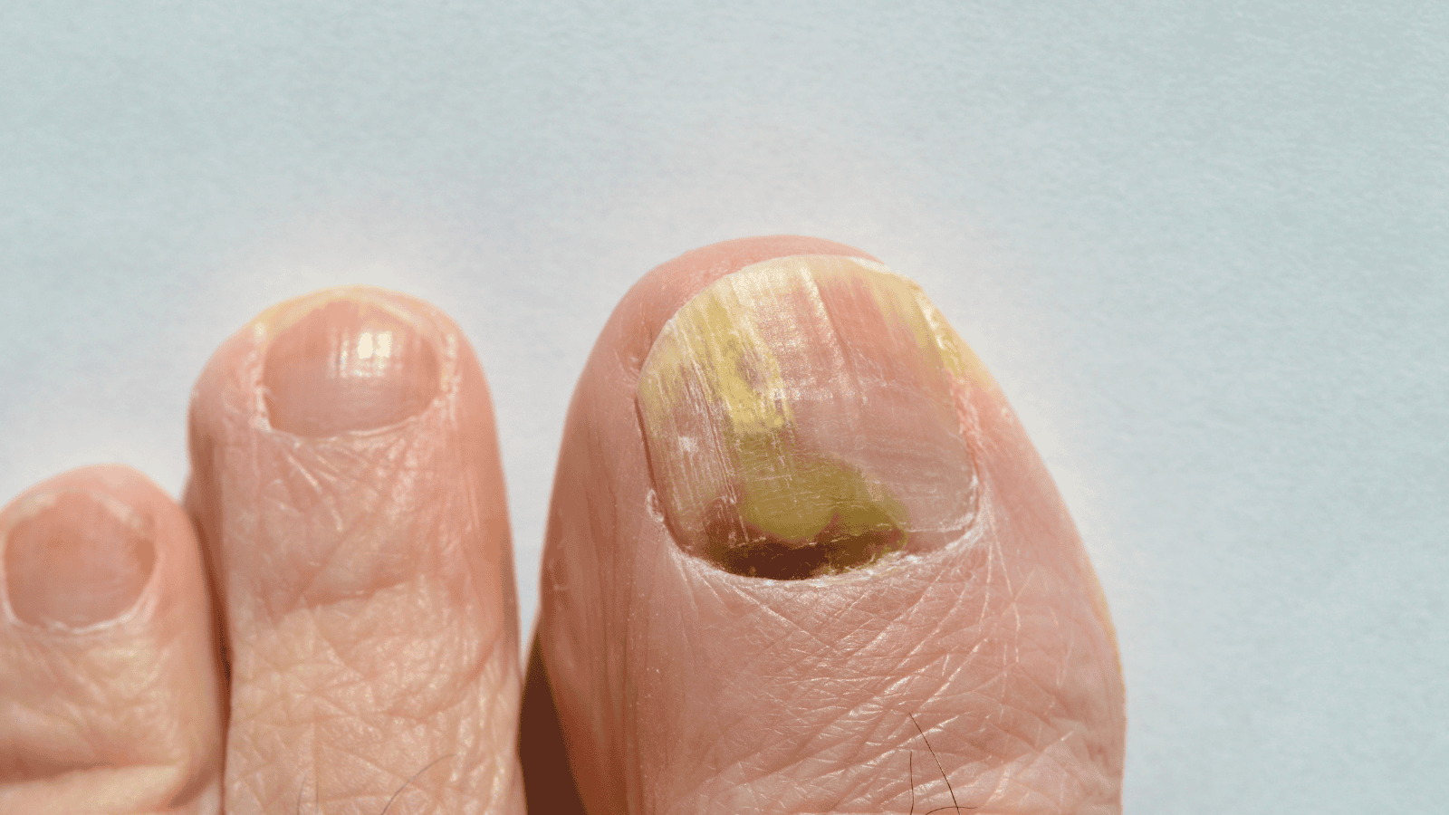 Izabela Nestioruk-Narojek