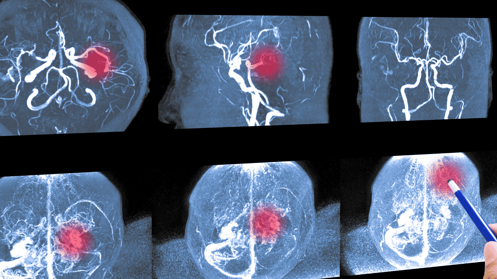 Izabela Nestioruk-Narojek